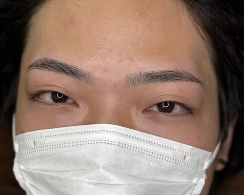 CASE01 施術後